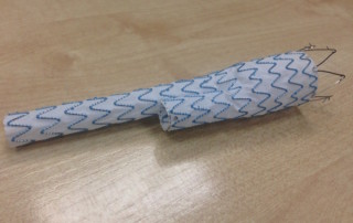 Stent Vascular